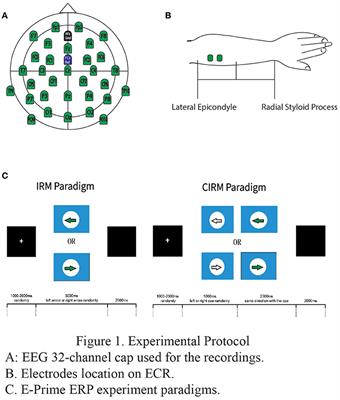 Combining Movement-Related Cortical Potentials and Event-Related Desynchronization to Study Movement Preparation and Execution